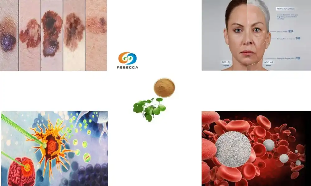 Can Centella Asiatica help reduce acne scars and hyperpigmentation? Can Centella Asiatica help reduce acne scars and hyperpigmentation?